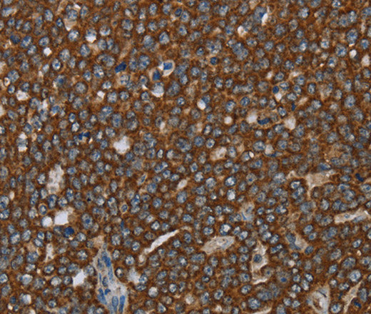 Anti-Human/Mouse/Rat GCKR Antibody - ABMIUM