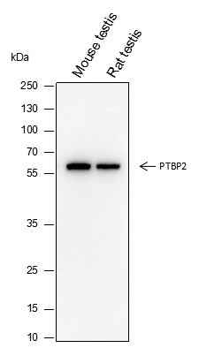Anti-Human/Rat/Mouse PTBP2 Antibody [A342] - ABMIUM