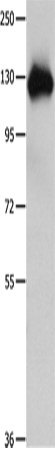 Anti-Human/Mouse AMPH Antibody - ABMIUM
