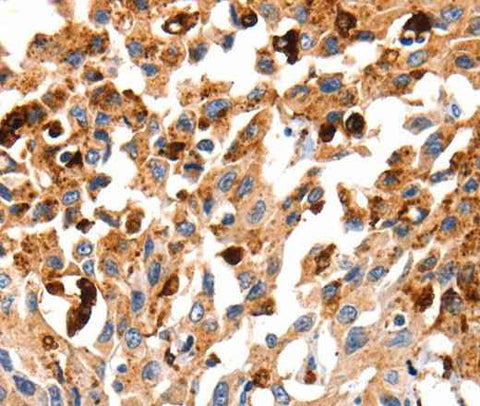 Anti-Human/Mouse/Rat CTSB Antibody