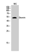 Western Blot analysis of VEC cells using Desmin Polyclonal Antibody at dilution of 1:2000.