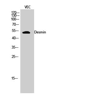 Western Blot analysis of VEC cells using Desmin Polyclonal Antibody at dilution of 1:2000.