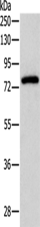 Anti-Human/Mouse/Rat PRKCG Antibody - ABMIUM