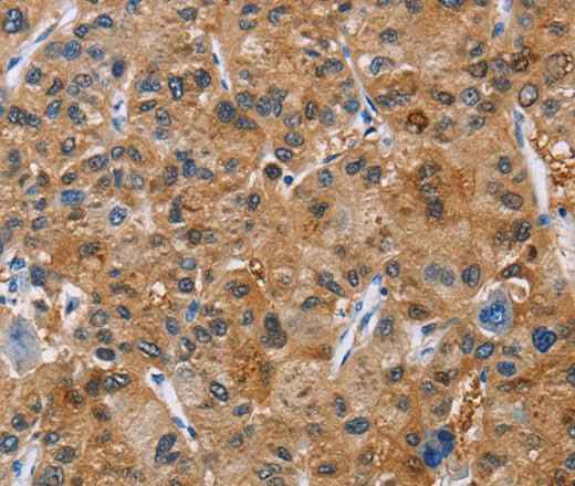 Anti-Human NCR3 Antibody