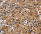 Anti-Human NCR3 Antibody - ABMIUM