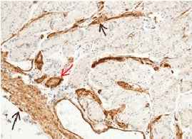 Anti-Human MCAM Antibody [B222] - ABMIUM