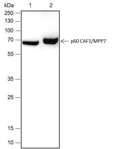 Anti-Human p60 CAF1/MPP7 Antibody [A453] - ABMIUM