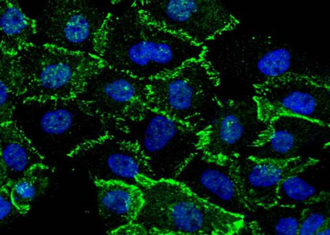Anti-Human CTNNB1 Antibody [B322] - ABMIUM