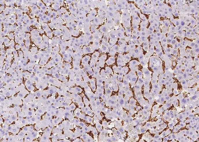 Anti-Human FCGR3B Antibody [A1051] - ABMIUM