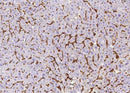 Anti-Human FCGR3B Antibody [A1051] - ABMIUM