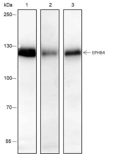 Anti-Human EPHB4 Antibody [A214] - ABMIUM