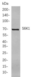 Anti-Human/Mouse/Rat S6K1 Antibody [B741]