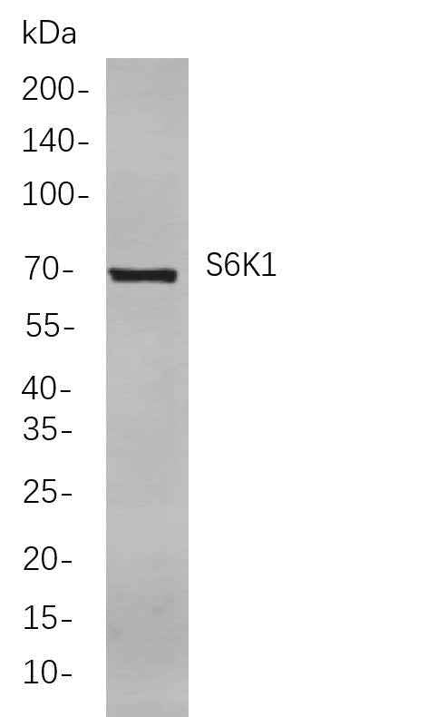 Anti-Human/Mouse/Rat S6K1 Antibody [B741]