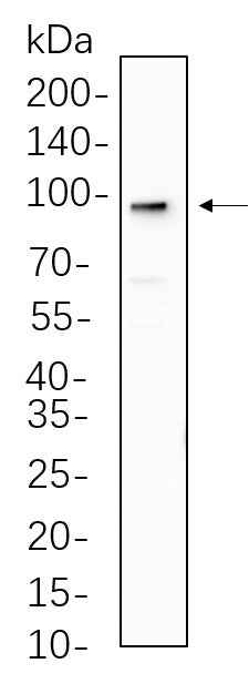 Anti-Human/Mouse/Rat AGO2 Antibody [B542] - ABMIUM