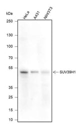 Anti-Human/Mouse SUV39H1 Antibody [A372]