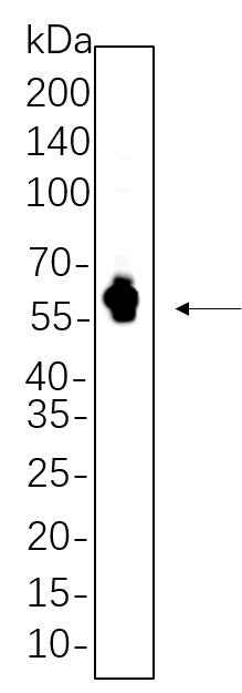 Anti-Human/Mouse/Rat Tau Antibody [B557] - ABMIUM