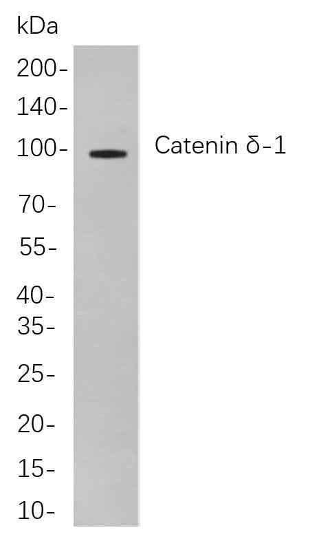 Anti-Human/Mouse/Rat Catenin δ-1 Antibody [B853] - ABMIUM