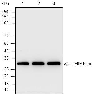 Anti-Human TFIIF beta Antibody [A780] - ABMIUM