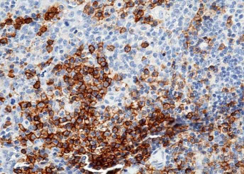 Anti-Human CD38 Antibody [A1125] - ABMIUM