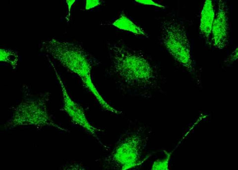 Anti-Human SIRT1 Antibody [A902] - ABMIUM