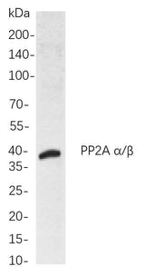 Anti-Human/Mouse/Rat PP2A α/β Antibody [B822]