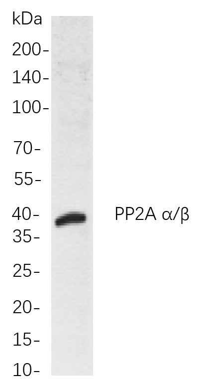 Anti-Human/Mouse/Rat PP2A α/β Antibody [B822] - ABMIUM