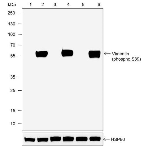Anti-Human/Rat/Mouse Phospho-Vimentin (Ser39) Antibody [A820] - ABMIUM