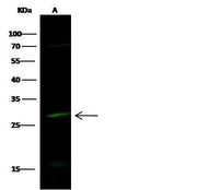 Anti-Human HPGD Antibody [A858] - ABMIUM