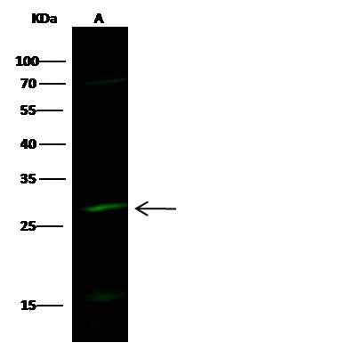 Anti-Human HPGD Antibody [A858] - ABMIUM
