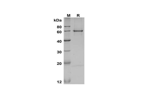 SDS-PAGE analysis of Mouse Pcsk9 proteins, 2 μg/lane of Recombinant Mouse Pcsk9 proteins, was resolved with SDS-PAGE under reducing conditions, showing bands at 59 kDa. and 19 kDa.