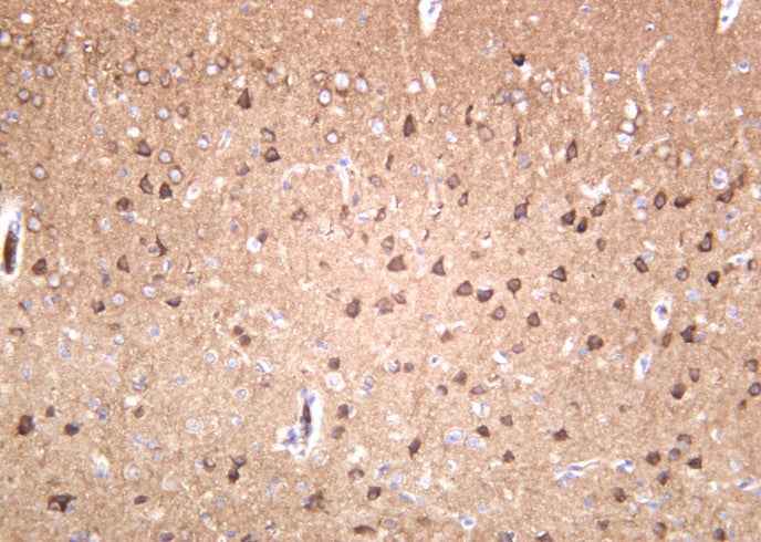 Anti-Human/Mouse/Rat GluR-2 Antibody [B1042] - ABMIUM