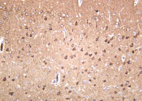 Anti-Human/Mouse/Rat GluR-2 Antibody [B1042] - ABMIUM