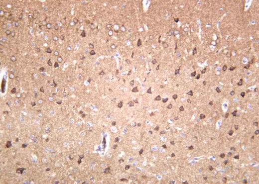 Anti-Human/Mouse/Rat GluR-2 Antibody [B1042] - ABMIUM