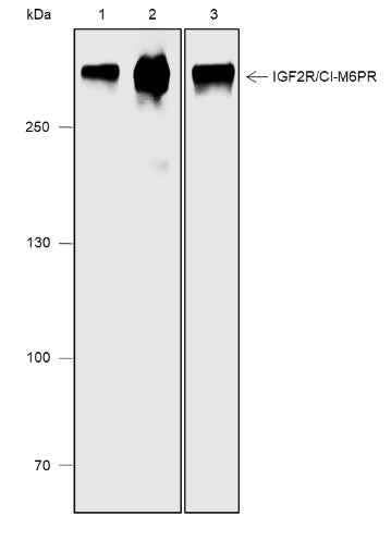 Anti-Human/Rat/Mouse IGF2R/CI-M6PR Antibody [A571] - ABMIUM