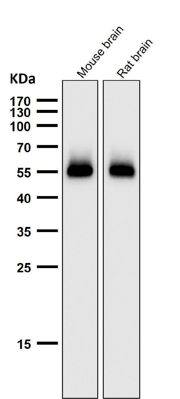 Anti-p53 (acetyl K370) TP53 Rabbit Monoclonal Antibody Boster Bio