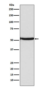 Anti-p53 (acetyl K382) TP53 Rabbit Monoclonal Antibody Boster Bio