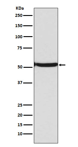 Anti-p53 (acetyl K382) TP53 Rabbit Monoclonal Antibody Boster Bio