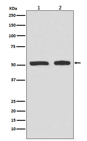 Anti-Phospho-p53 (S9) TP53 Rabbit Monoclonal Antibody Boster Bio