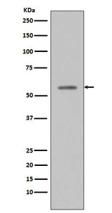 Anti-Phospho-p53 (S33) TP53 Rabbit Monoclonal Antibody Boster Bio