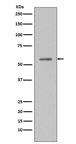 Anti-Phospho-p53 (S33) TP53 Rabbit Monoclonal Antibody Boster Bio