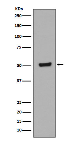 Anti-Phospho-p53 (T55) TP53 Rabbit Monoclonal Antibody Boster Bio