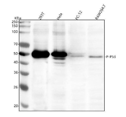 Anti-Phospho-p53 (S392) TP53 Rabbit Monoclonal Antibody Boster Bio
