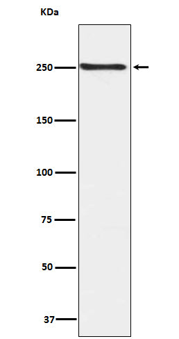 Anti-Phospho-mTOR (S2448) Rabbit Monoclonal Antibody Boster Bio
