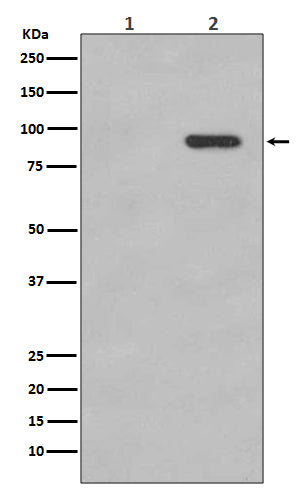 Anti-Phospho-beta Catenin (S33/S37) CTNNB1 Rabbit Monoclonal Antibody Boster Bio