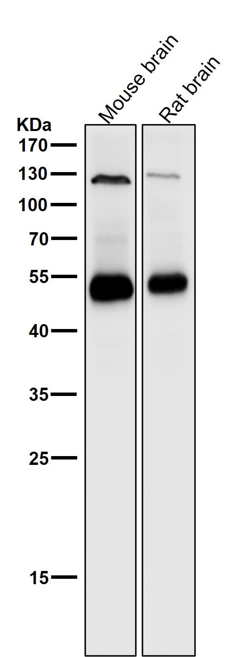 Anti-Phospho-PTEN (S380) Rabbit Monoclonal Antibody Boster Bio
