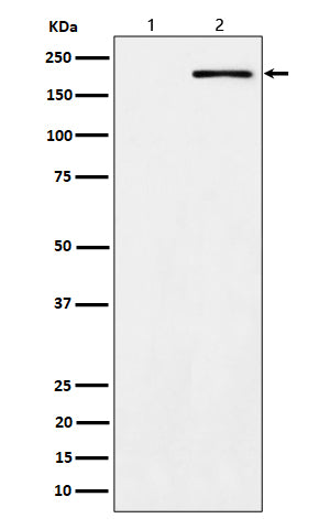 Anti-Phospho-ErbB2 (Y1139) Rabbit Monoclonal Antibody Boster Bio