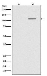Anti-Phospho-SIRT1 (S47) Rabbit Monoclonal Antibody Boster Bio