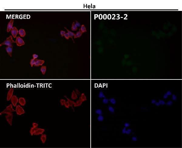 Anti-Phospho-EGFR (Y1197) Rabbit Monoclonal Antibody Boster Bio