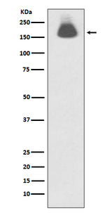 Anti-Phospho-EGFR (S695) Rabbit Monoclonal Antibody Boster Bio