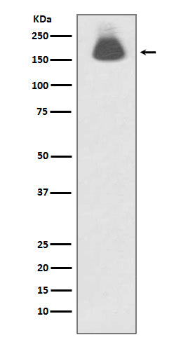 Anti-Phospho-EGFR (S695) Rabbit Monoclonal Antibody Boster Bio